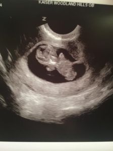 10 w, 3 d ultrasound
